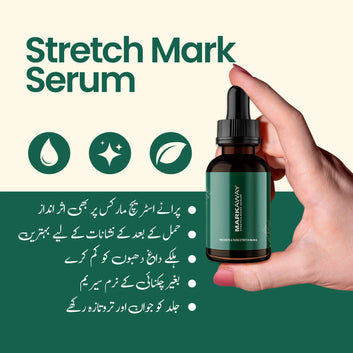 ✨ Mark Away – Stretch Mark Remover Serum ✨